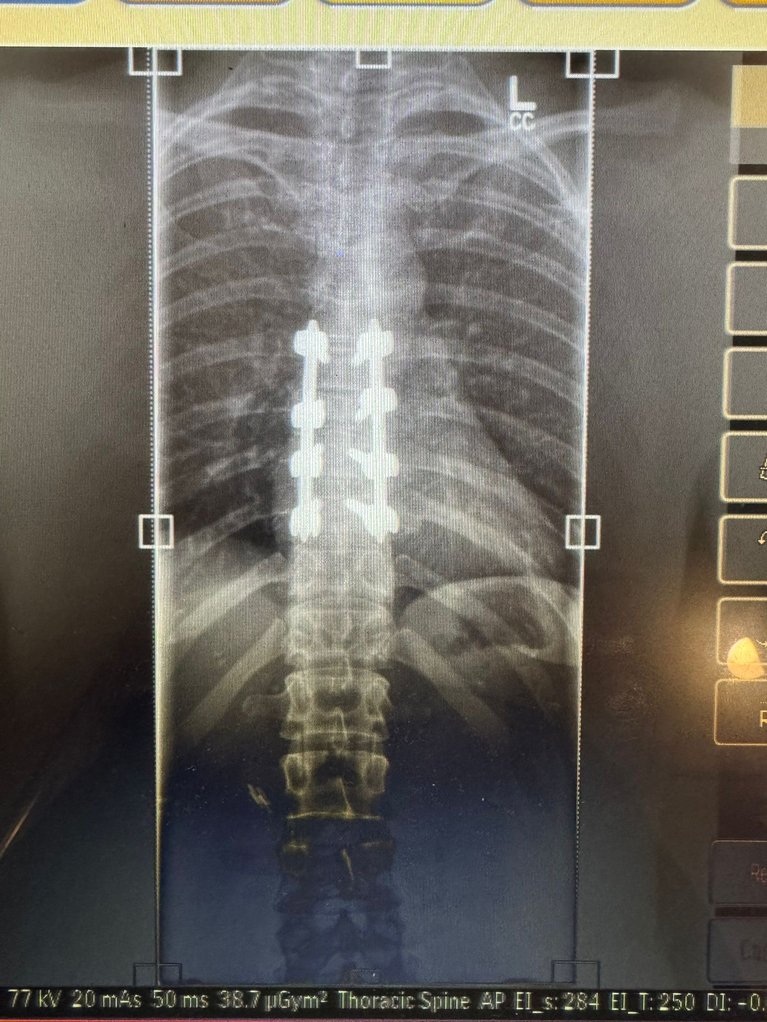 BACK XRAY.JPG